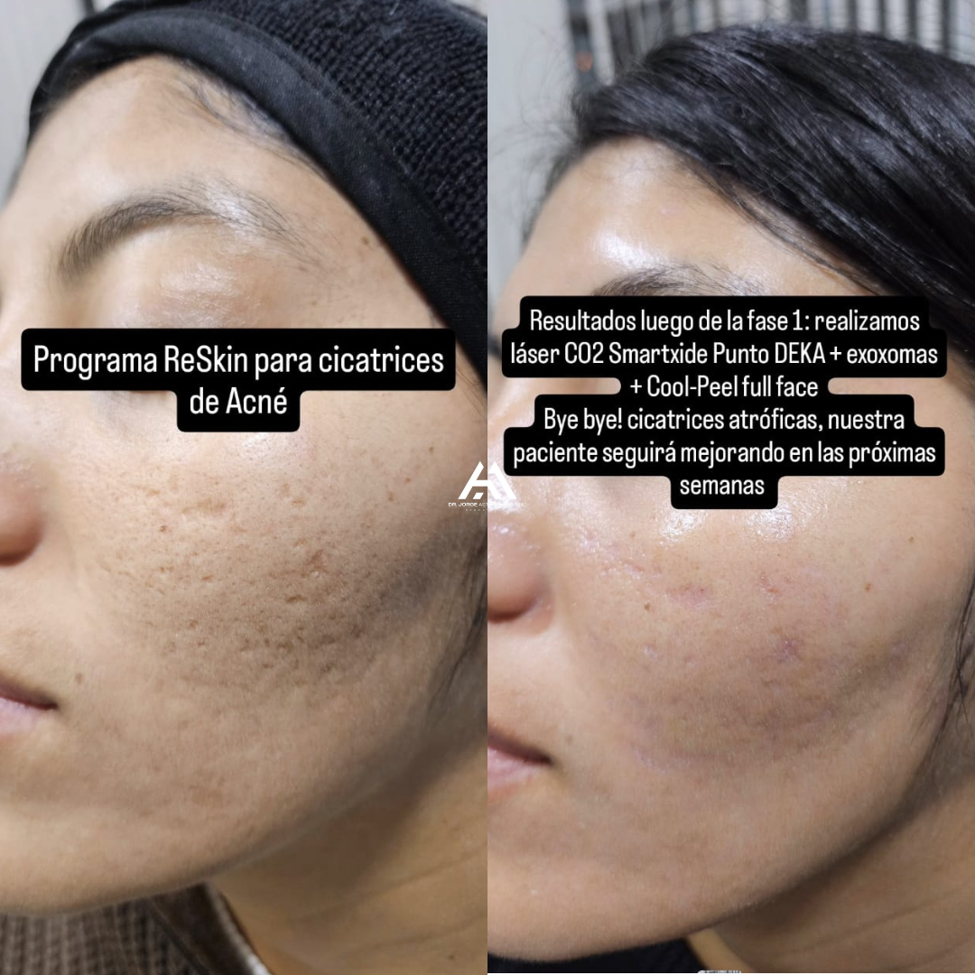 Dr Jorge Asto Dermatología Facebook ad