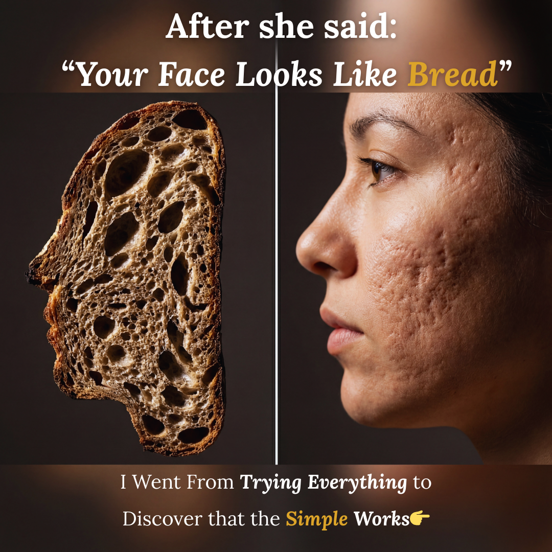 Autumn Rose Facebook ad: My Face Looked Like Bread because of the 'Holes' (The Fix)