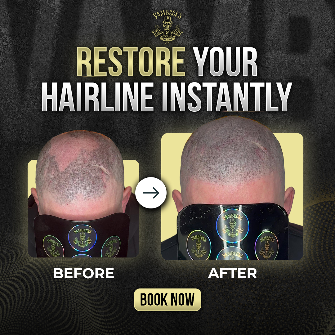 Vambecks SMP Facebook ad: Donegal, 15% Off Scalp Micropigmentation