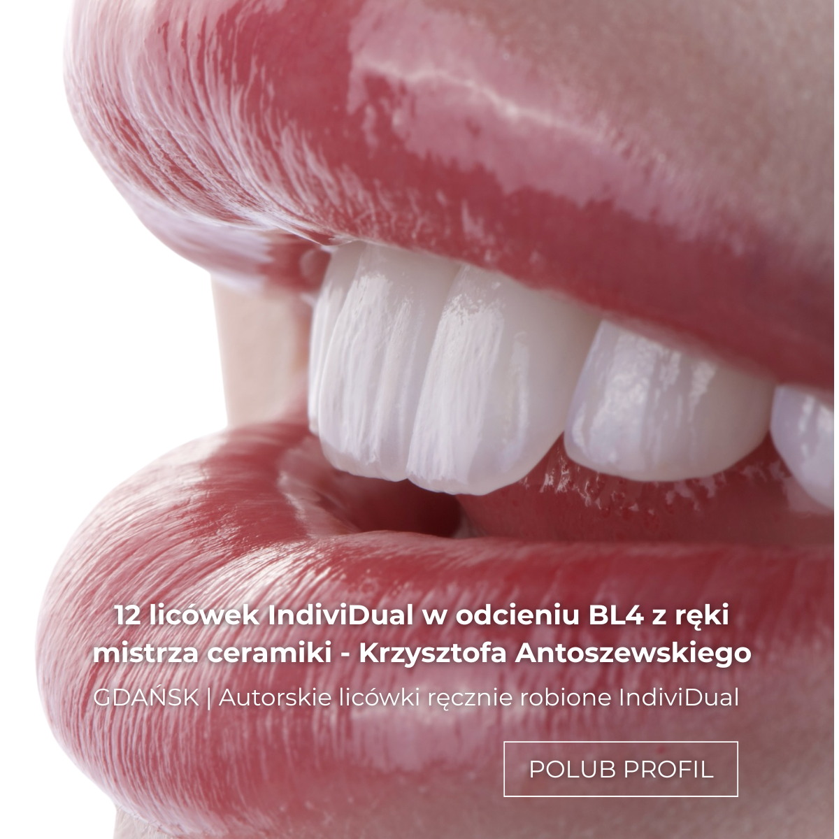 Dual Dental Clinic Facebook ad: Nowe zęby to ogromna odpowiedzialność.