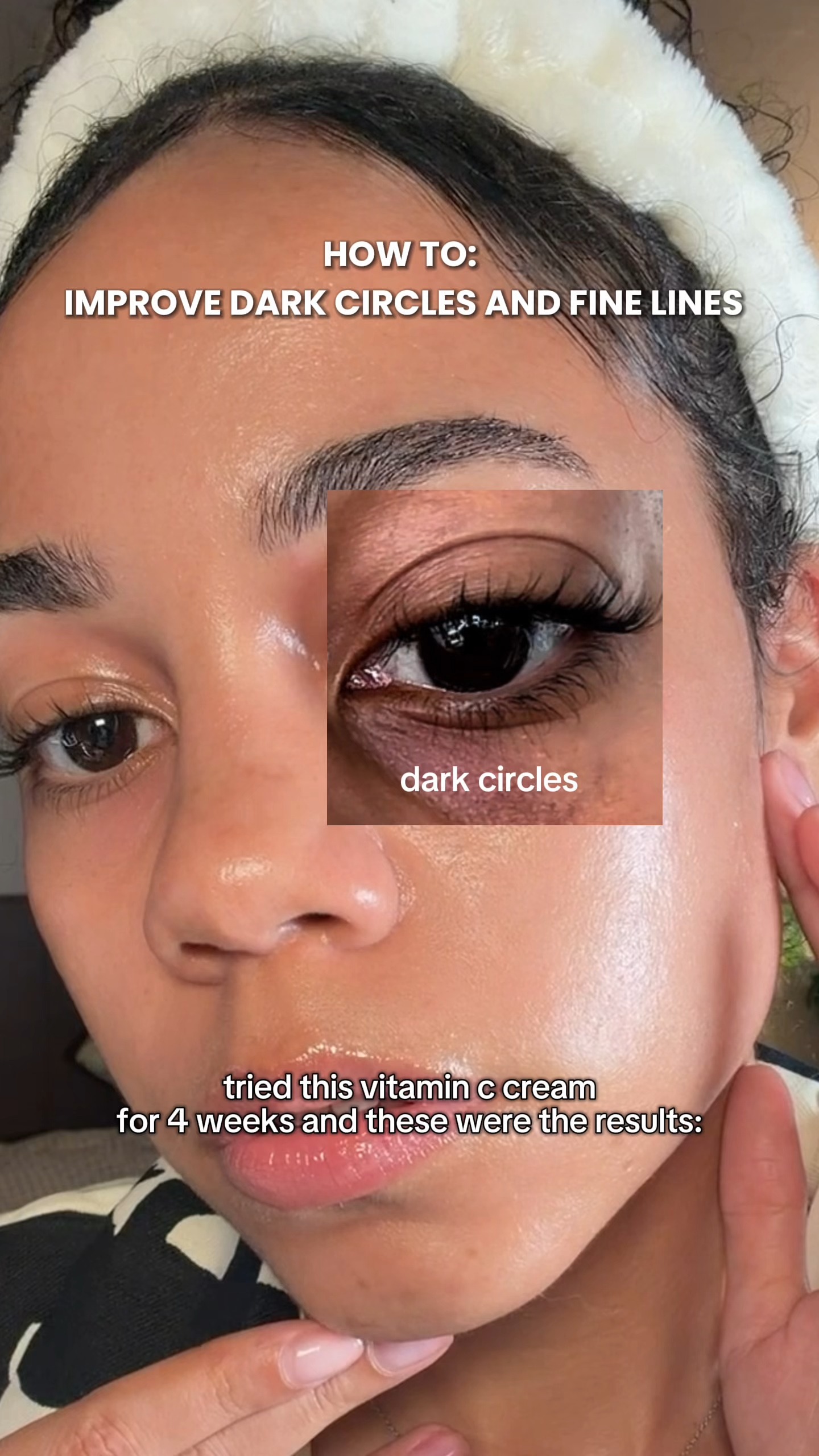 Arencia Global Facebook ad: if you also struggle with dark spots, pleasee…