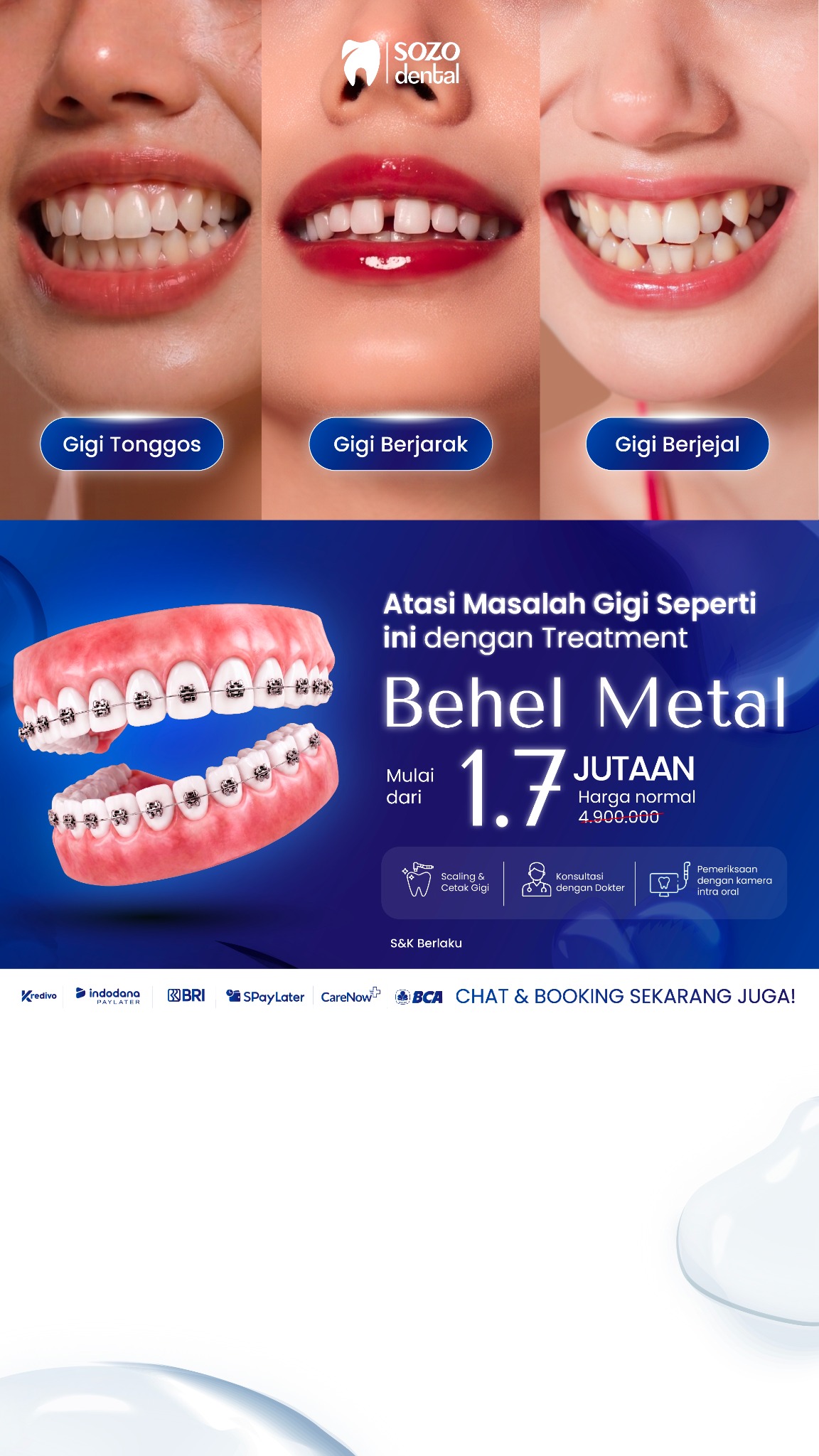Sozo Dental Clinic Facebook ad: Promo Behel Sozo Dental