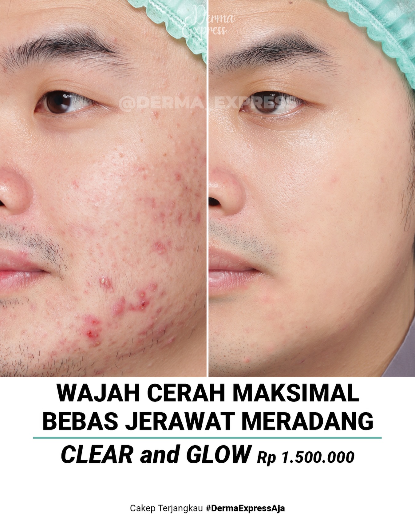 derma_express Facebook ad