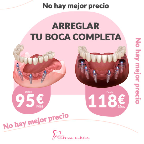 Grupo Dental Clinics Facebook ad