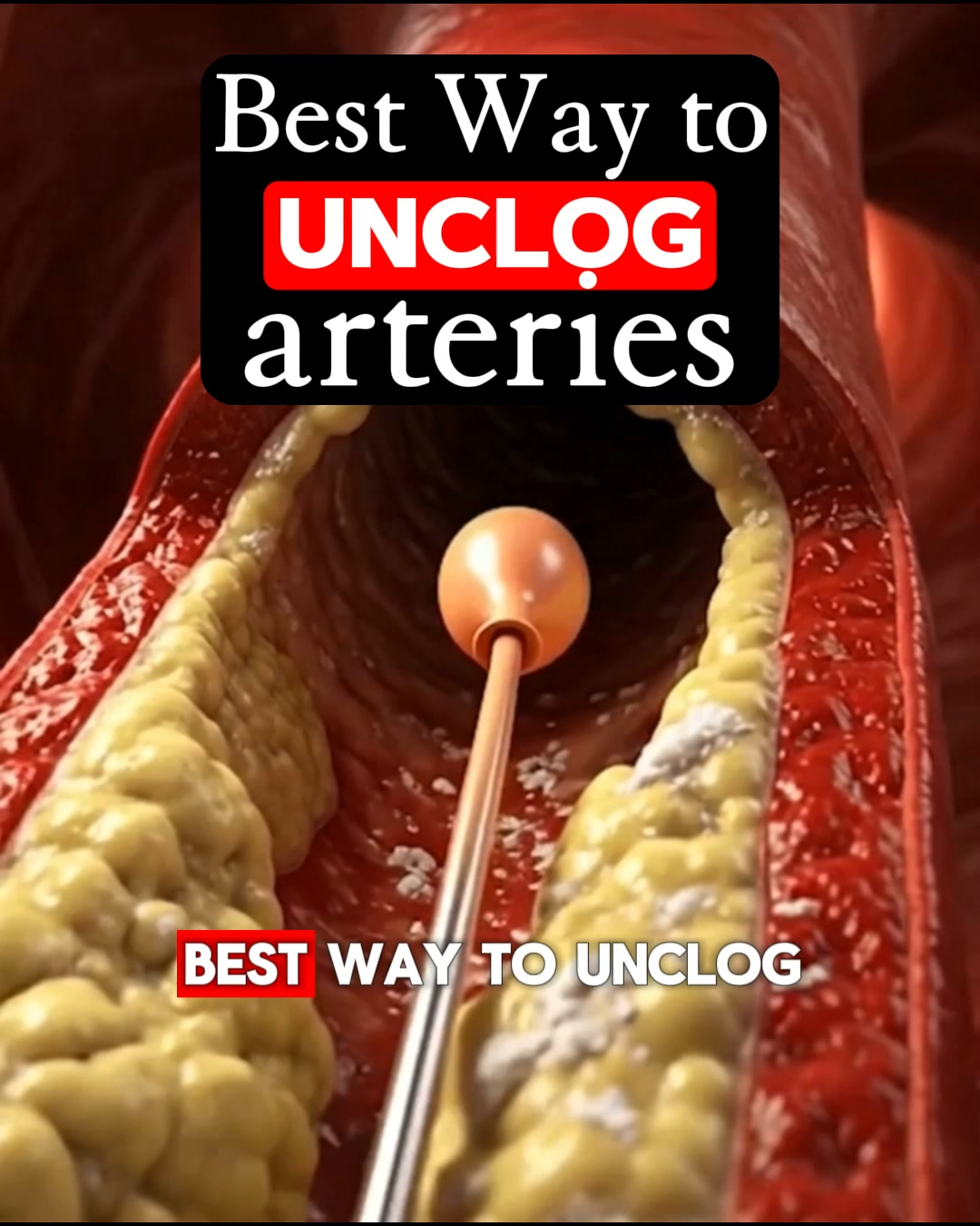 The Health Community Facebook ad: Got Artery Plaque? What Are You Waiting For?