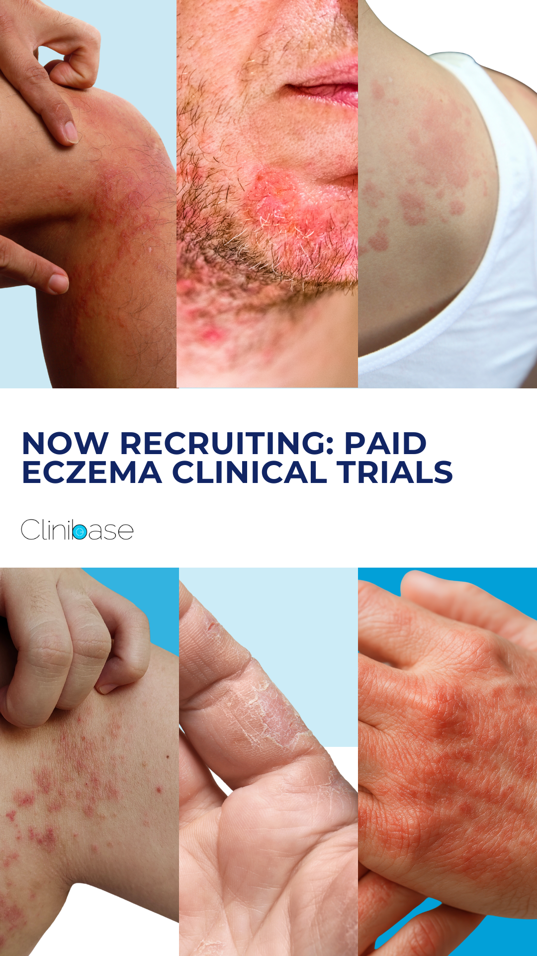 Clinibase Recruitment Facebook ad
