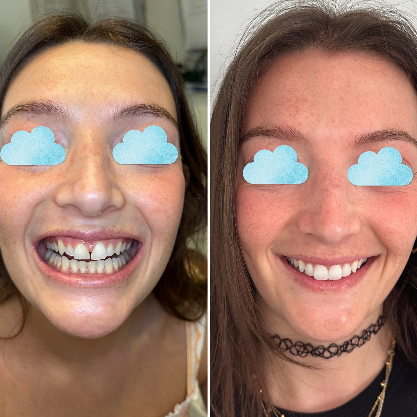 dentistabari_dottscorca Facebook ad: Come abbiamo realizzato questo meraviglioso sorriso in…
