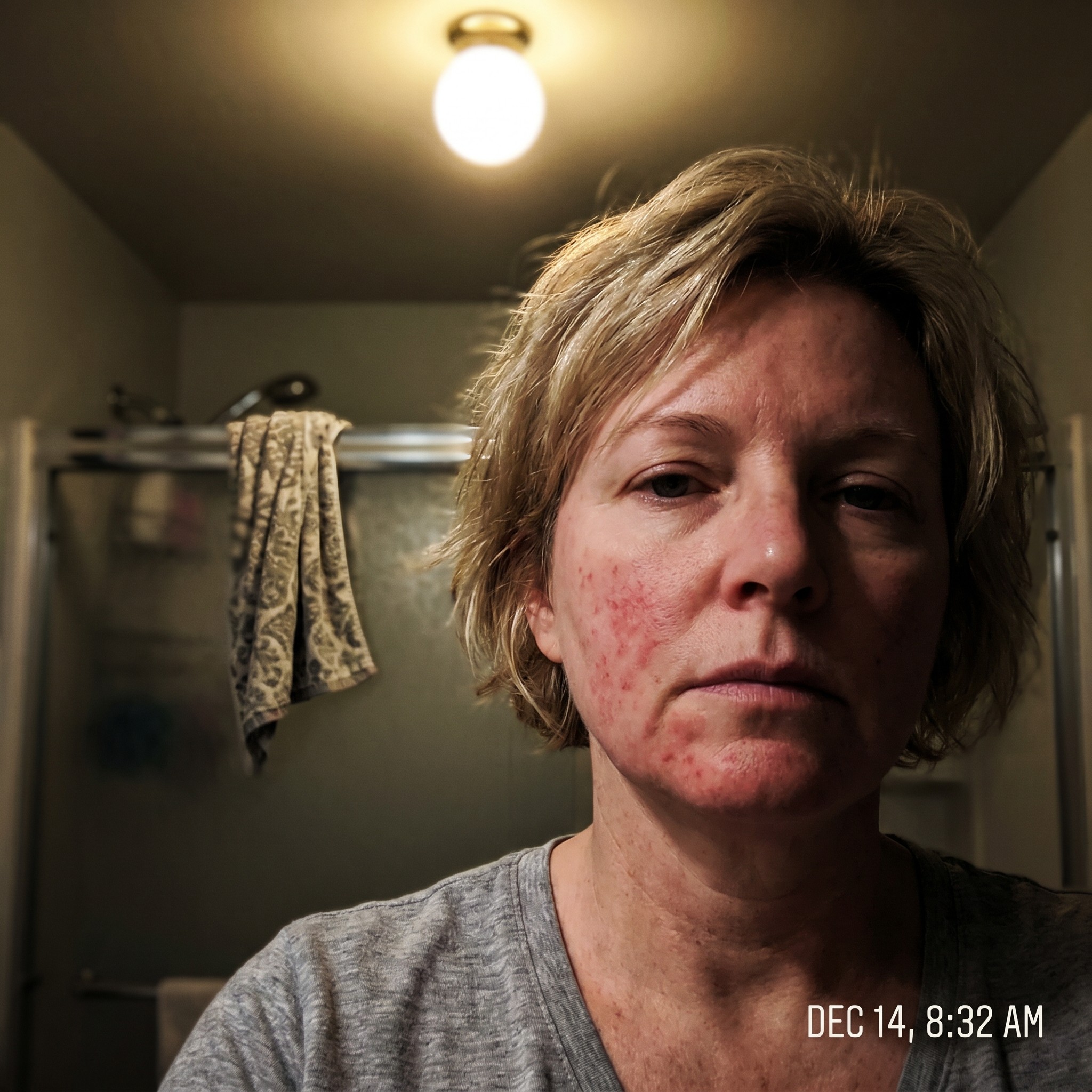 Michelle Mason Facebook ad: The Korean Dermatologist Who Fixed My Rosacea In 20 Minutes