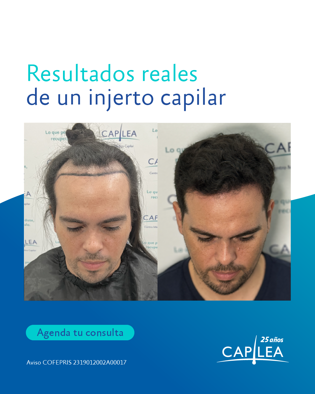 Capilea México Facebook ad