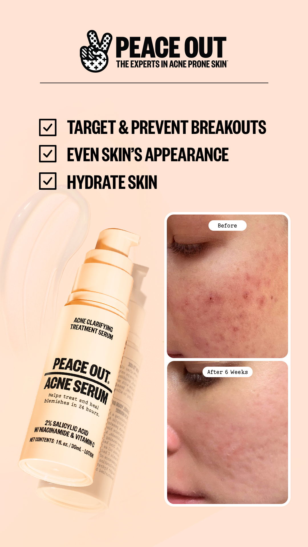Peace Out Skincare Facebook ad