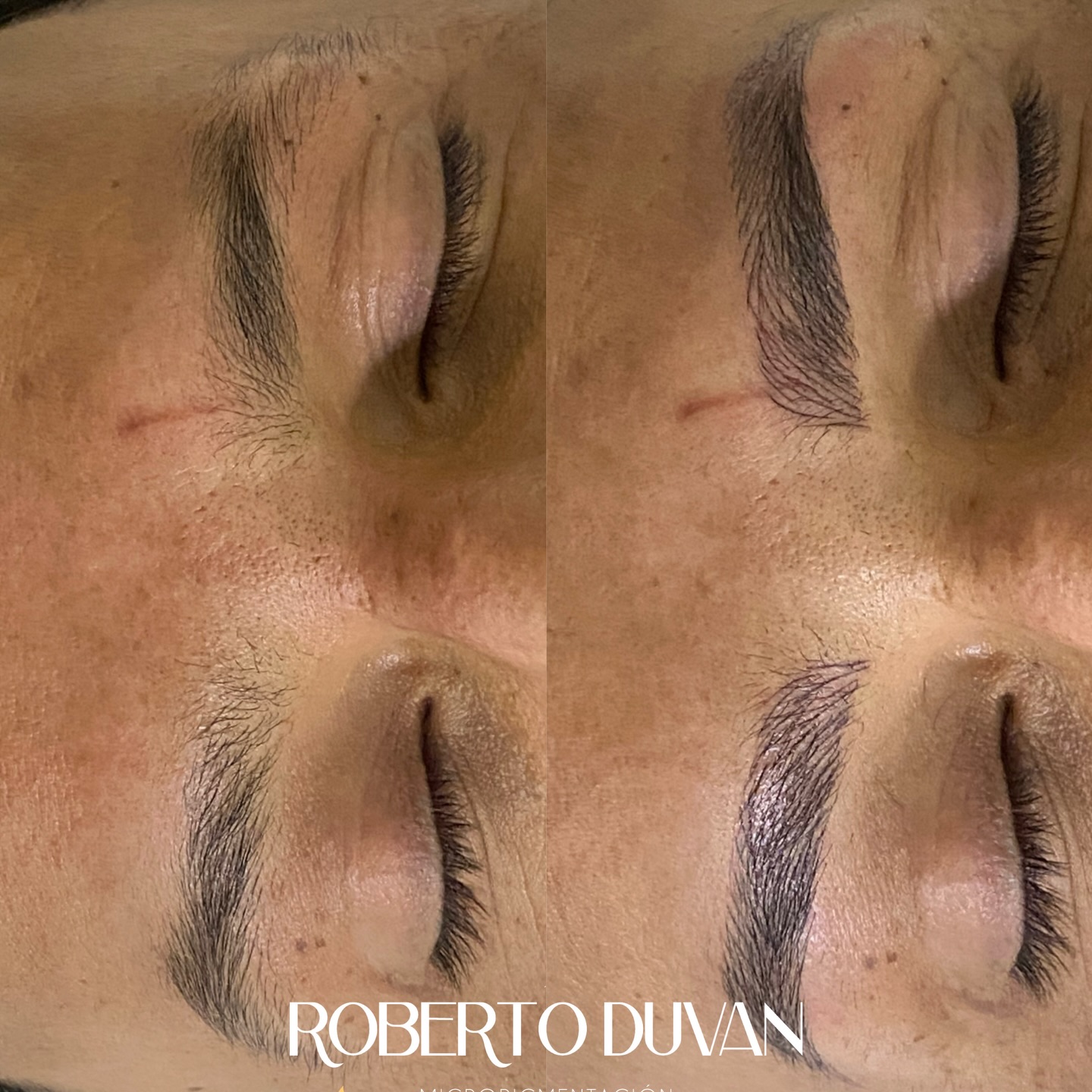 Centro de Estética Y Micropigmentacion Roberto Duvan Facebook ad: La micropigmentación de cejas pelo a pelo para…