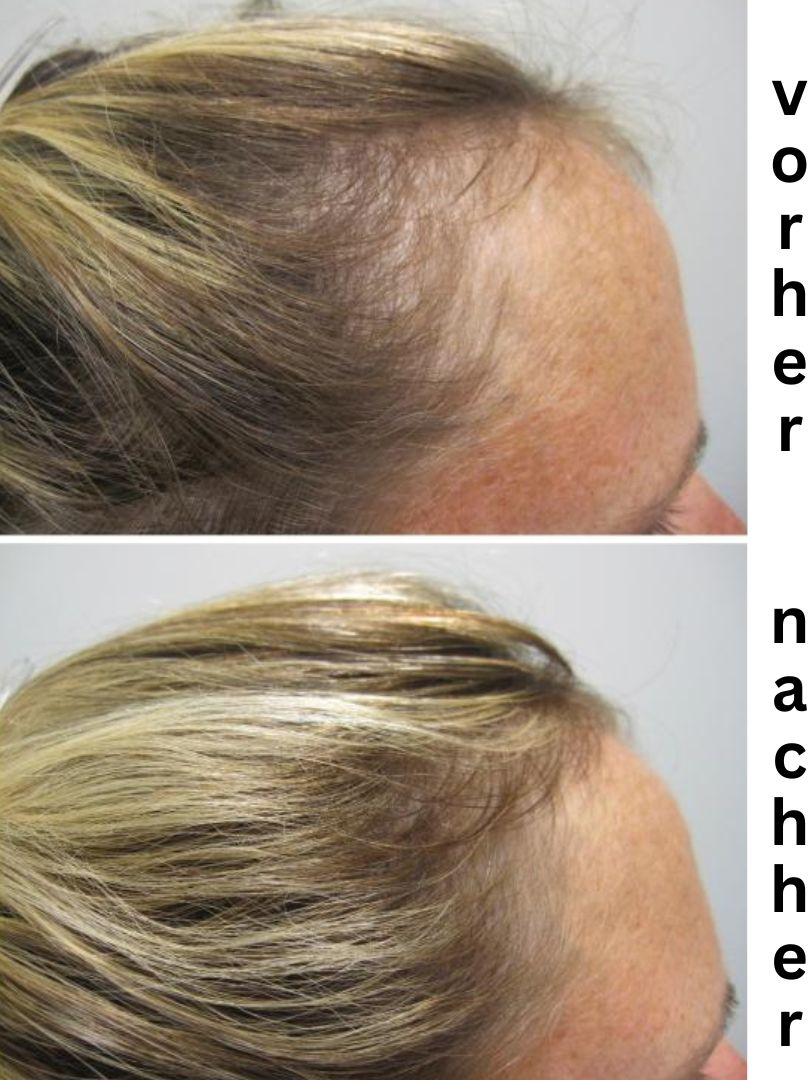 Apotheken Gesundheit Facebook ad