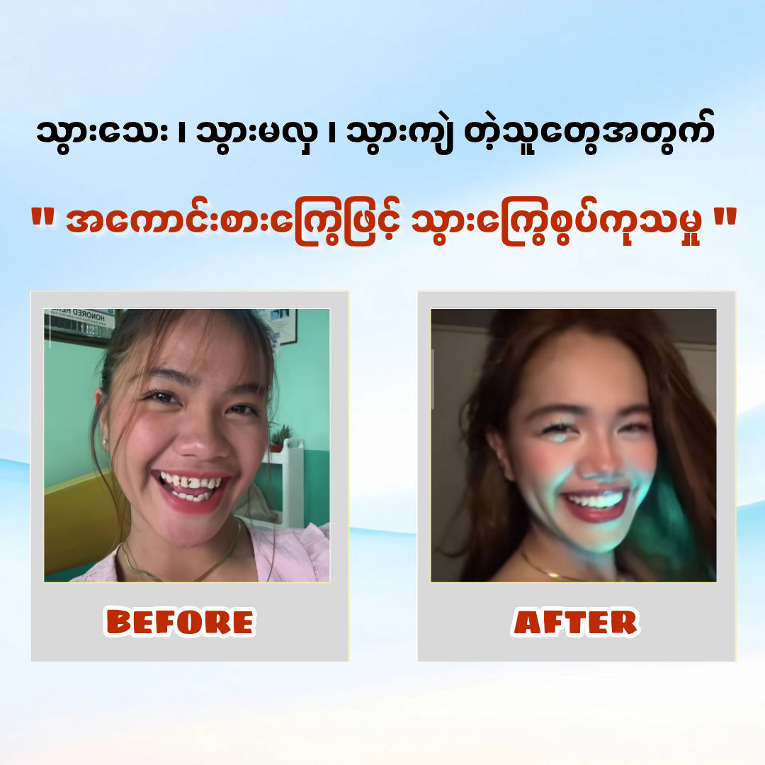 ๐๐ซ.๐๐ฆ๐ข๐ฅ๐ แแฝแฌแธแแพแแบแทแแถแแฝแแบแธแแฑแธแแแบแธ - แแฏแถแแฝแฌแแผแญแฏแท Facebook ad: แแฝแฌแธแแพแแพแแฑแธแแฝแฑแแผแแบแ
แฝแแบแแญแฏแแบแแฌแแฒแท