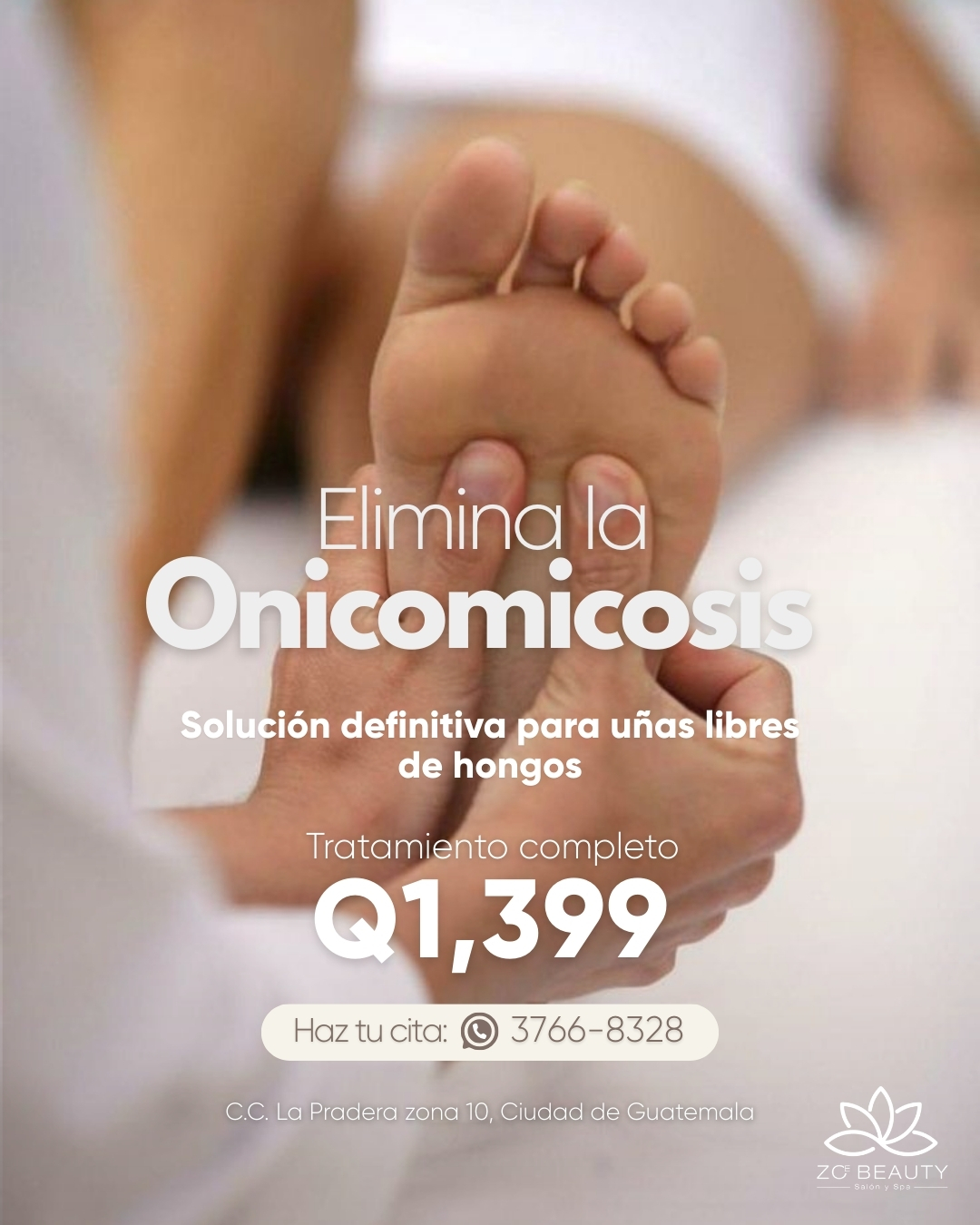 Zoe Beauty Salón & Spa Facebook ad: Onicomicosis