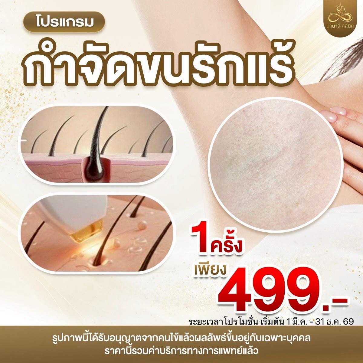 นาตาลี คลินิกเวชกรรม สาขา สุพรรณบุรี Facebook ad: โปรแกรมกำจัดขนรักแร้