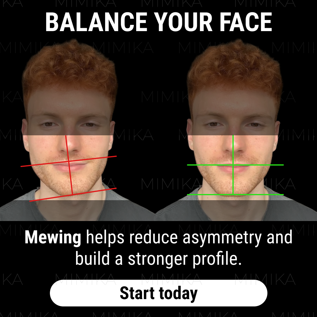 Kyle Mewing Facebook ad from Jan 20, 2026