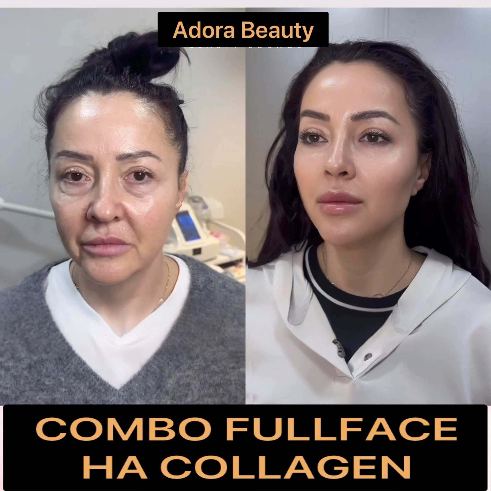 ADORA Beauty Hub - no.1 Center in Manila Facebook ad