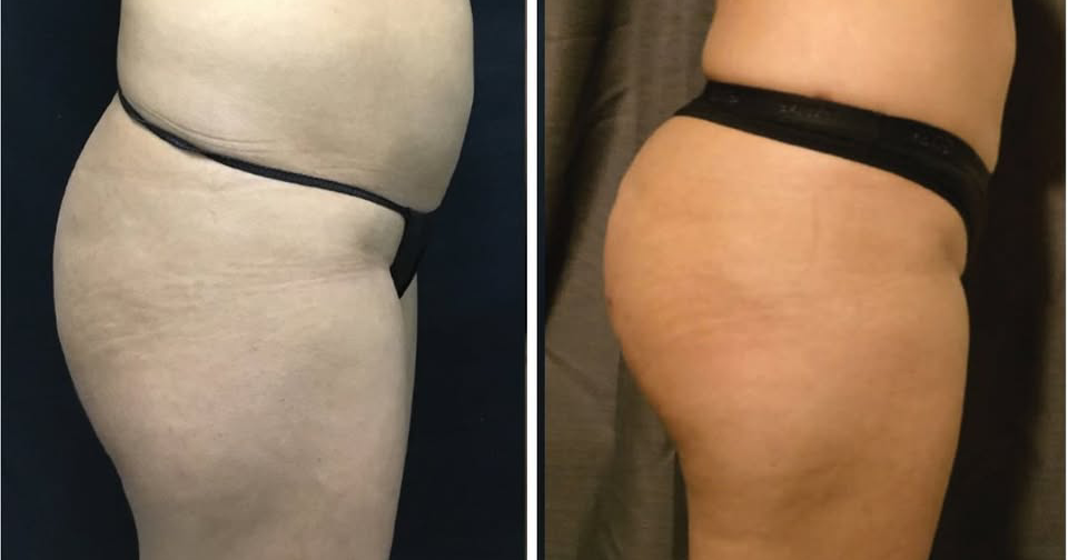 PFMedicine Facebook ad: Our anti-aging wellness clinic allows our patients to…