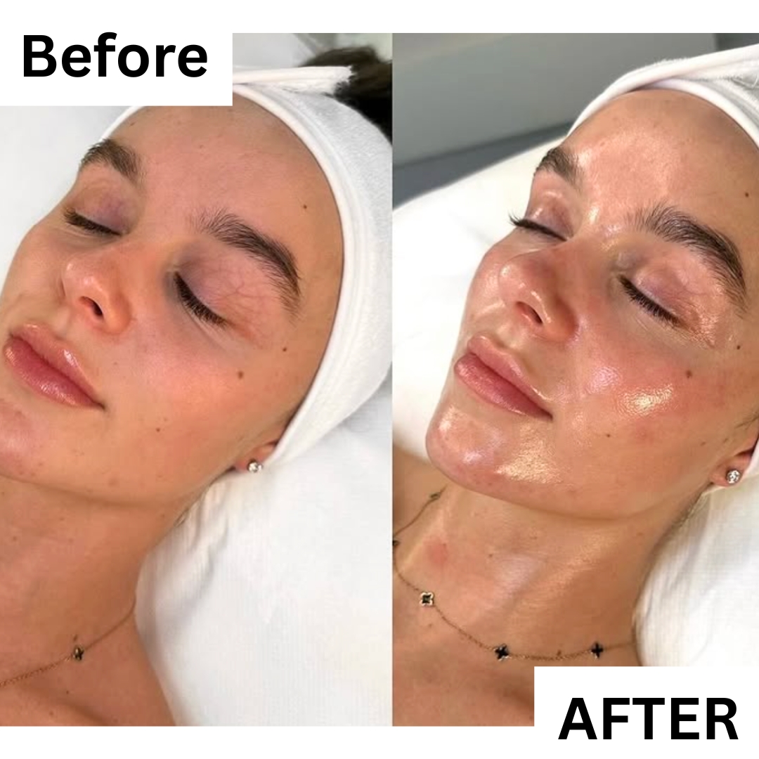 Timeless Spa Center - Chattanooga, TN Facebook ad