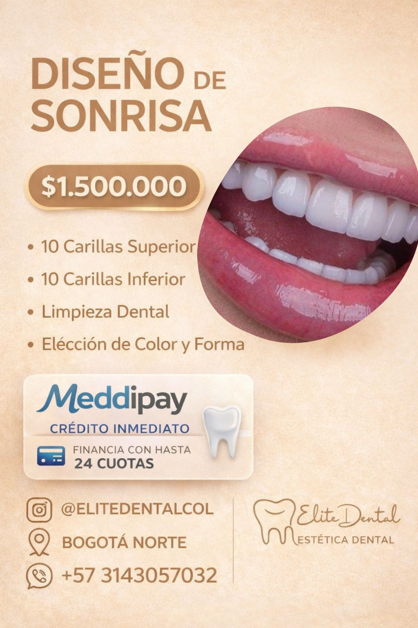 Diseño de sonrisa ed Facebook ad: FINANCIA TU DISEÑO DE SONRISA