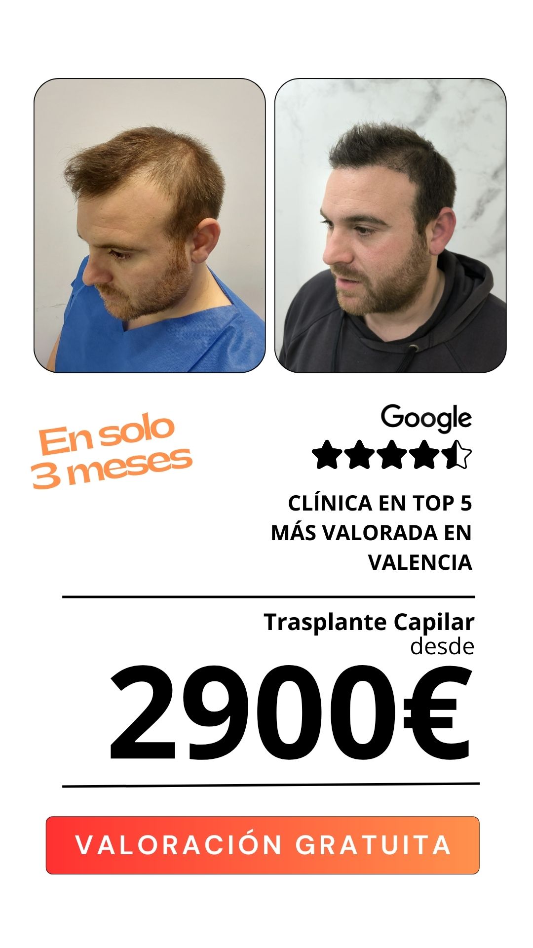 Clínica salud capilar  Facebook ad
