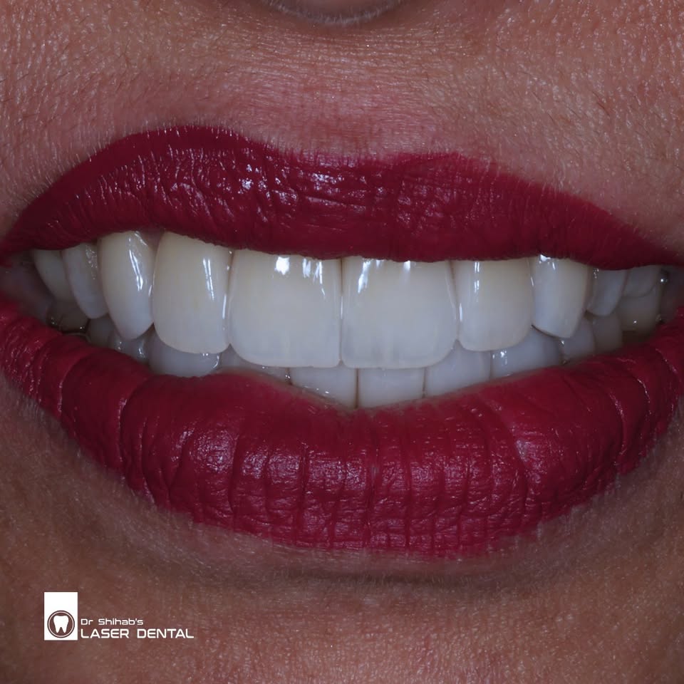 LASER DENTAL Facebook ad