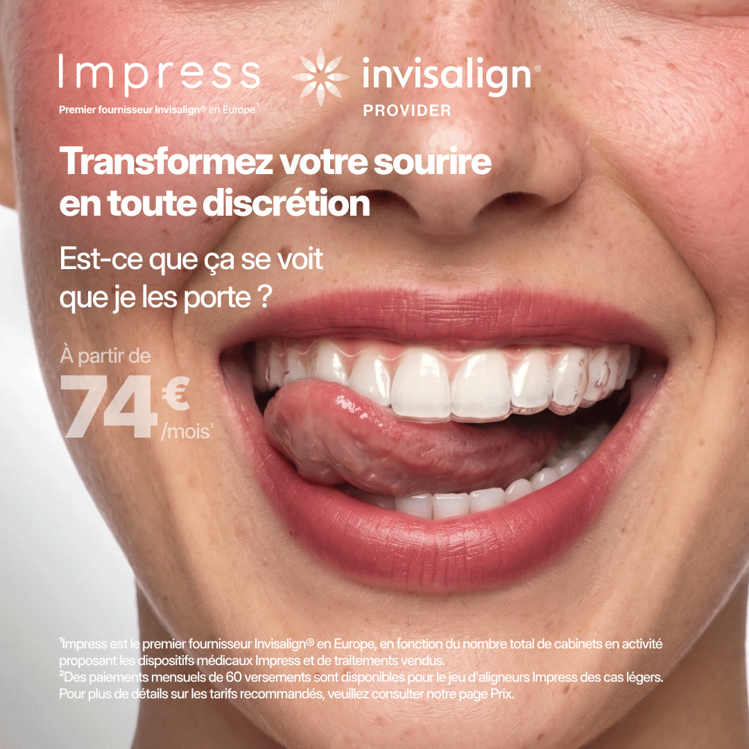 Impress_fr Facebook ad: Êtes-vous éligible?