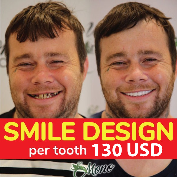 Mono Cosmetic Health Facebook ad: SMILE DESIGN