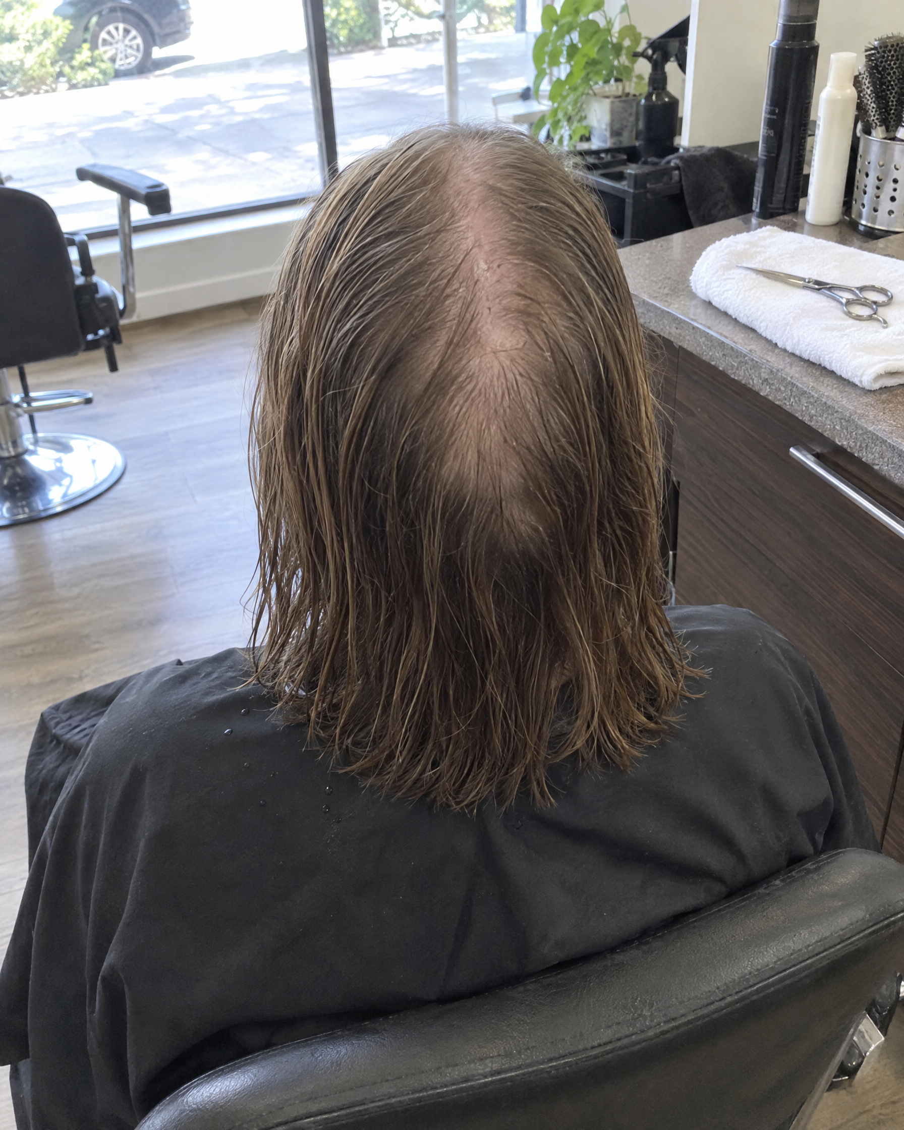 Susan Smith Facebook ad: Offered minoxidil for life or a wig? Read this
