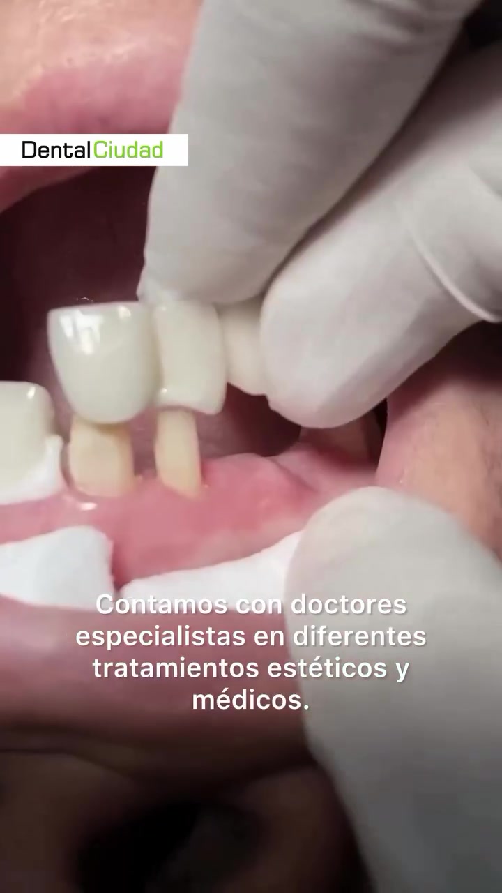 Dental Ciudad Facebook ad: En el Centro de Buenos Aires y en el Barrio Once Mas de…