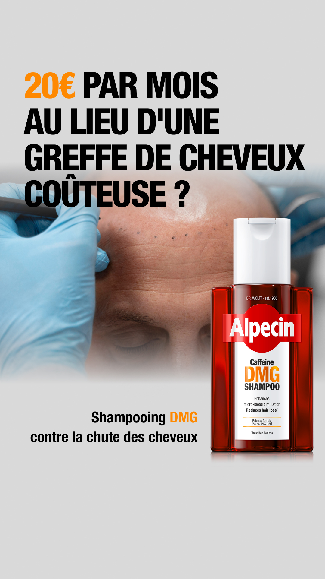 Alpecin Facebook ad from Jul 2, 2026