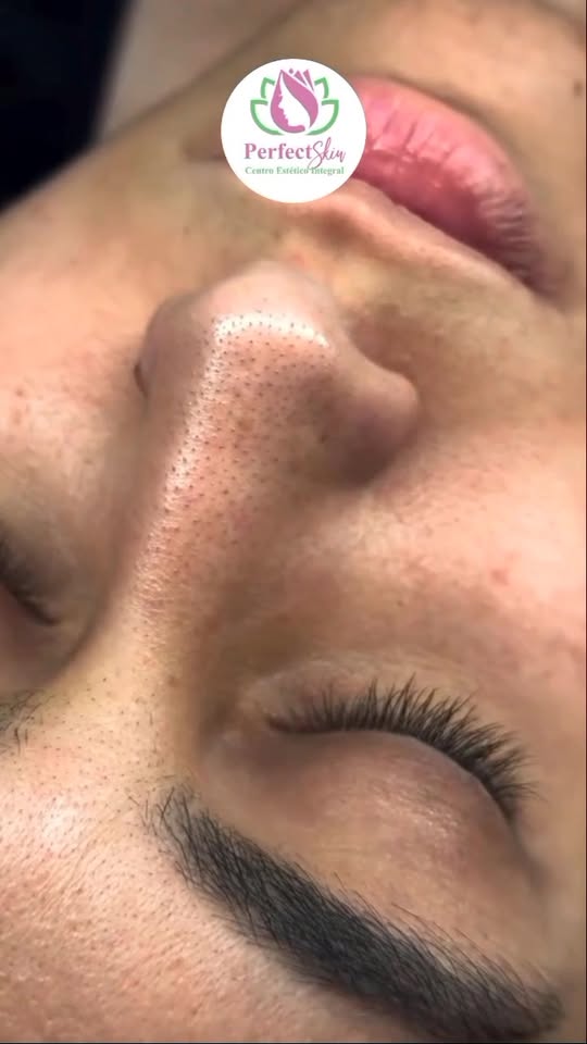 Perfect Skin Ambato Facebook ad: Perfect Skin