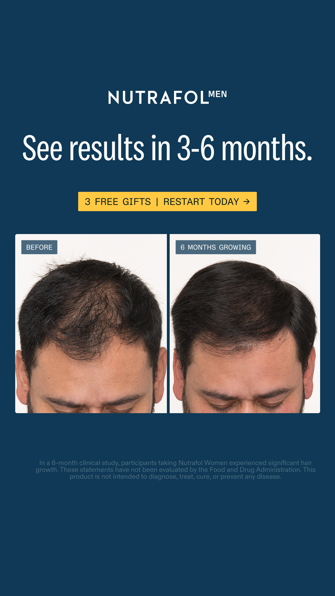 Nutrafol Men Facebook ad