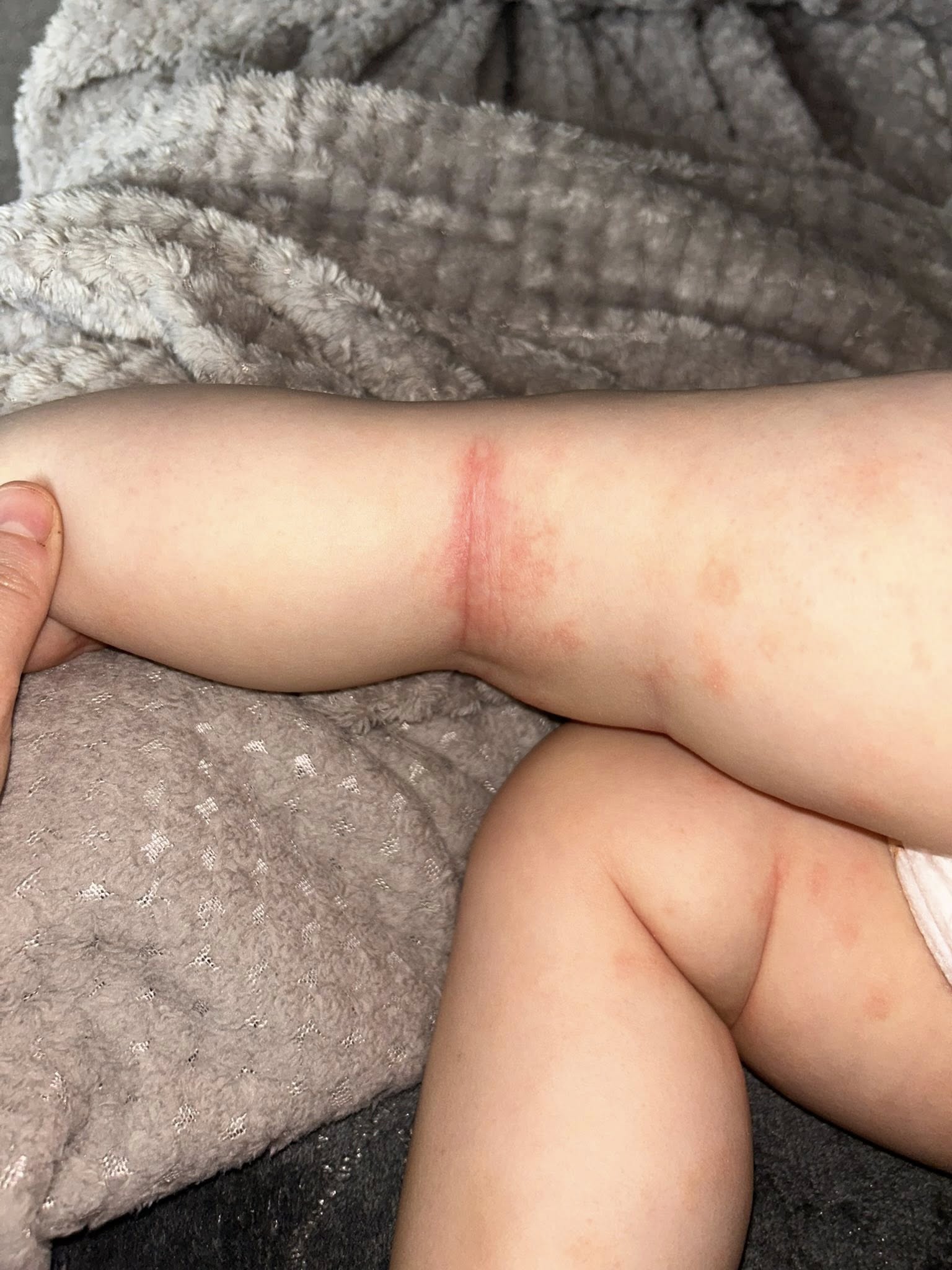 Eczema Mom Facebook ad: Read this if your baby has eczema