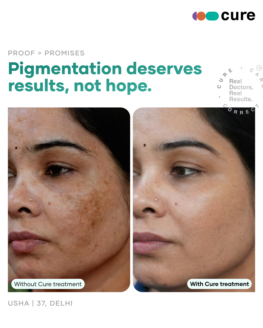 Cureskin Facebook ad: Prescribed Glow, Delivered to You