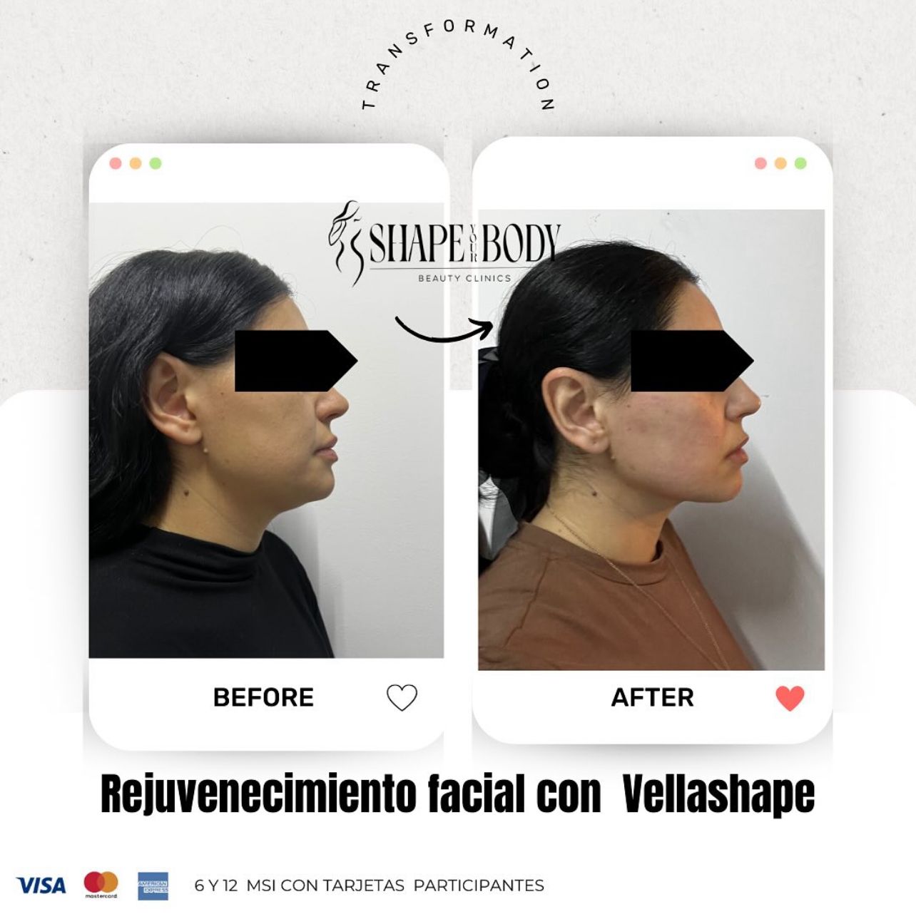 Shape Your Body Beauty Clinics Facebook ad: Chatea con nosotros