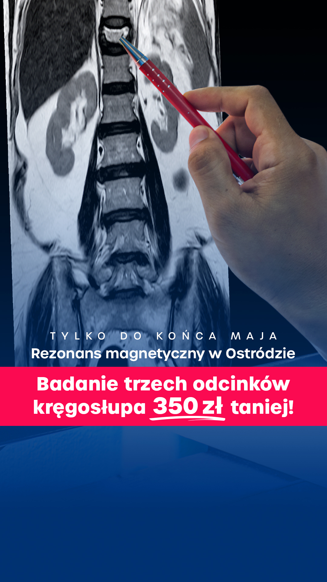 MR Diagnostic Rezonans Magnetyczny Facebook ad from May 7, 2026