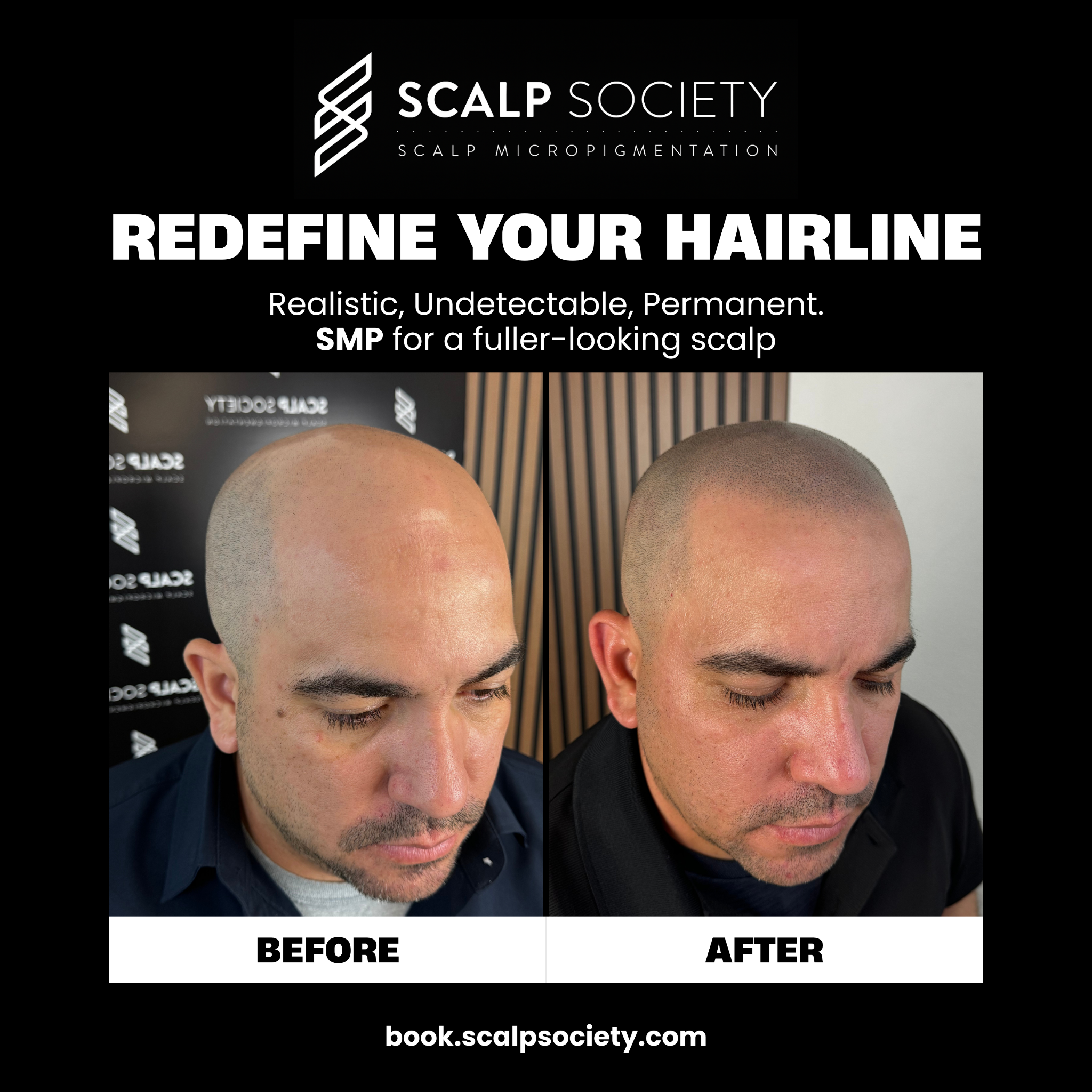 Scalp Society - Scalp Micropigmentation Clinic Facebook ad