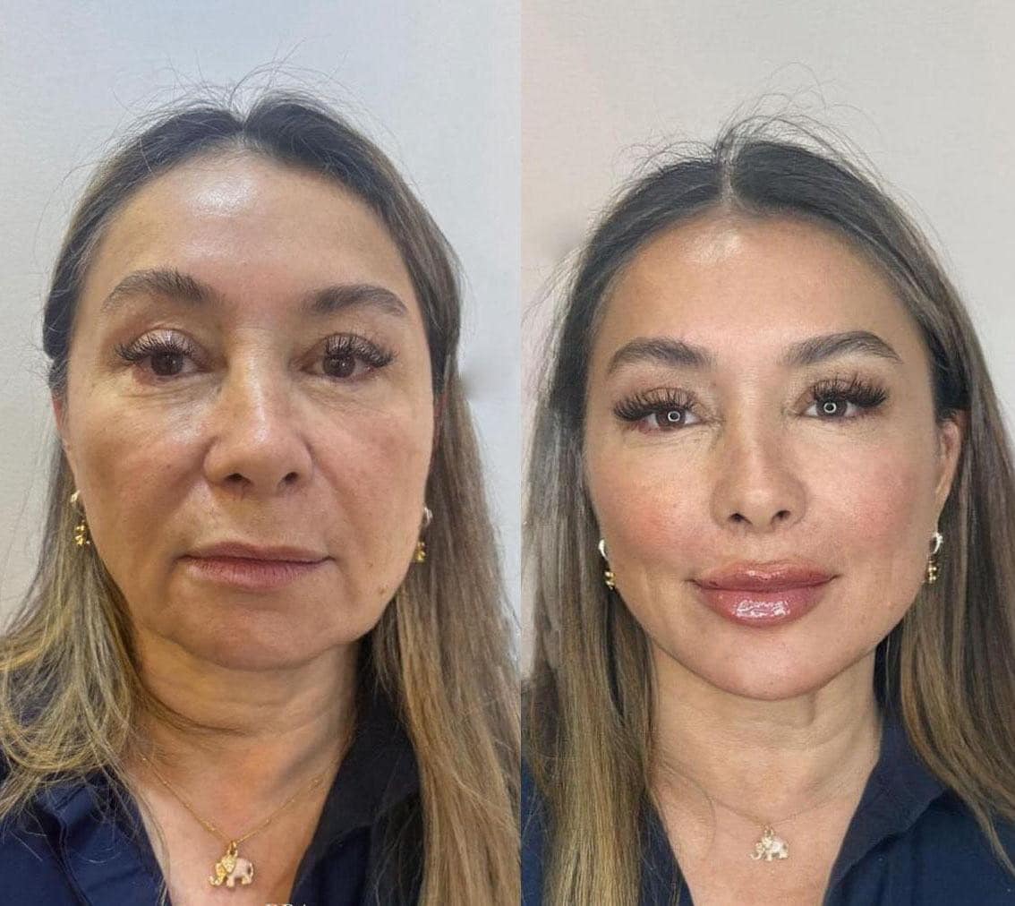 Clinica spa arte cuerpo  Facebook ad