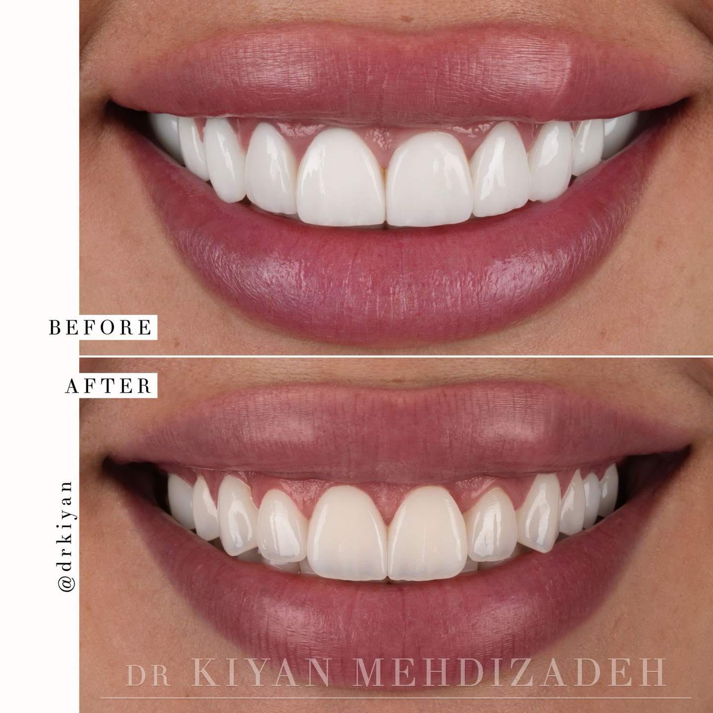 Dr Kiyan Mehdizadeh, DMD Facebook ad: This lovely patient traveled from Atlanta to get…