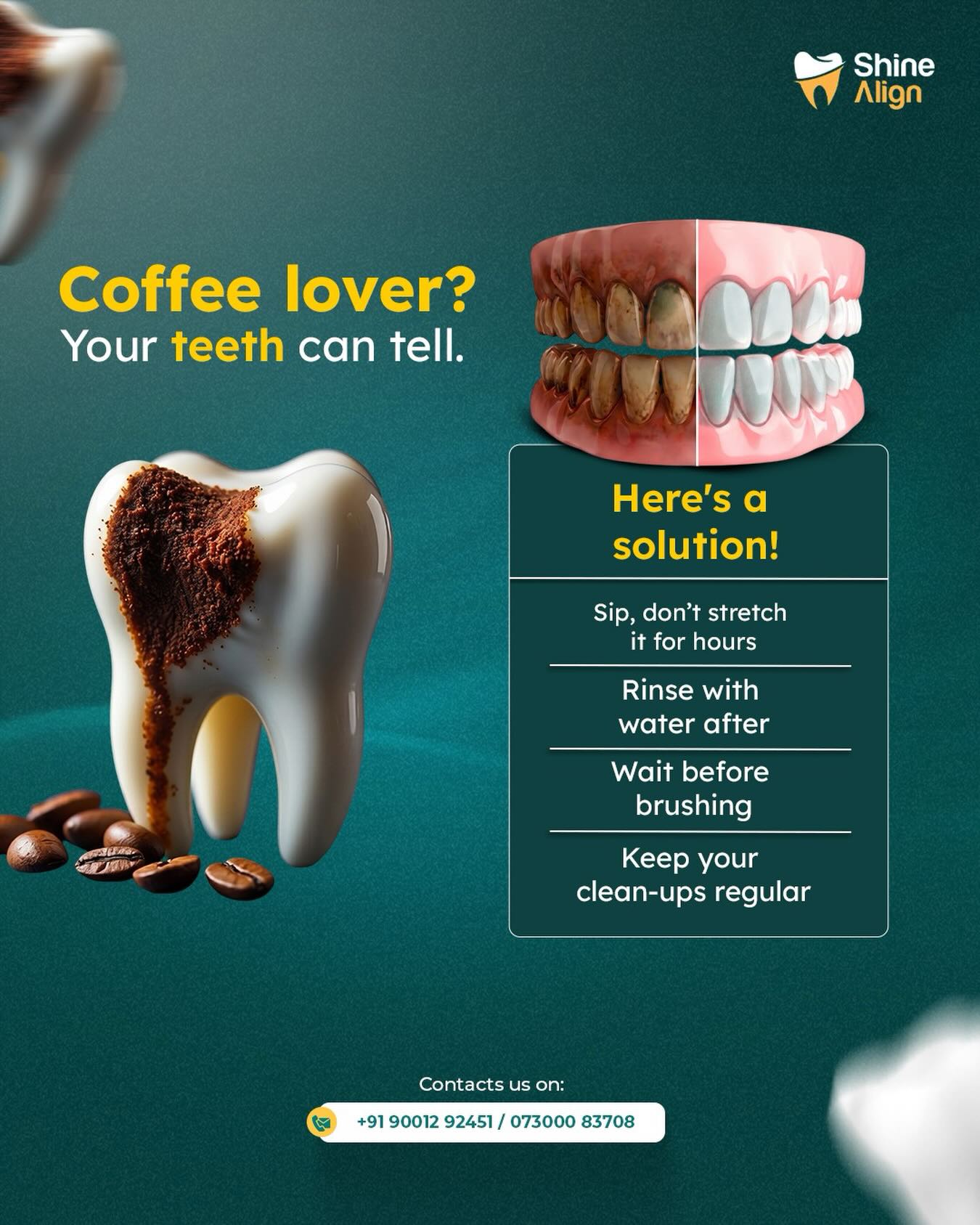 Shine Align Dental Care Facebook ad