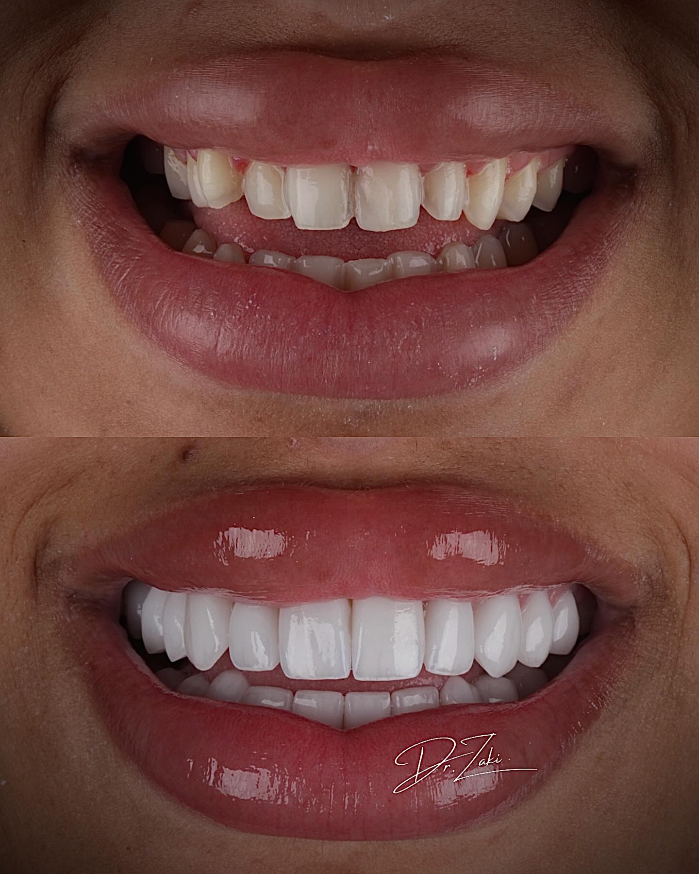 Dr. Zaki Facebook ad: Um grande desafio se transformou em um grande…