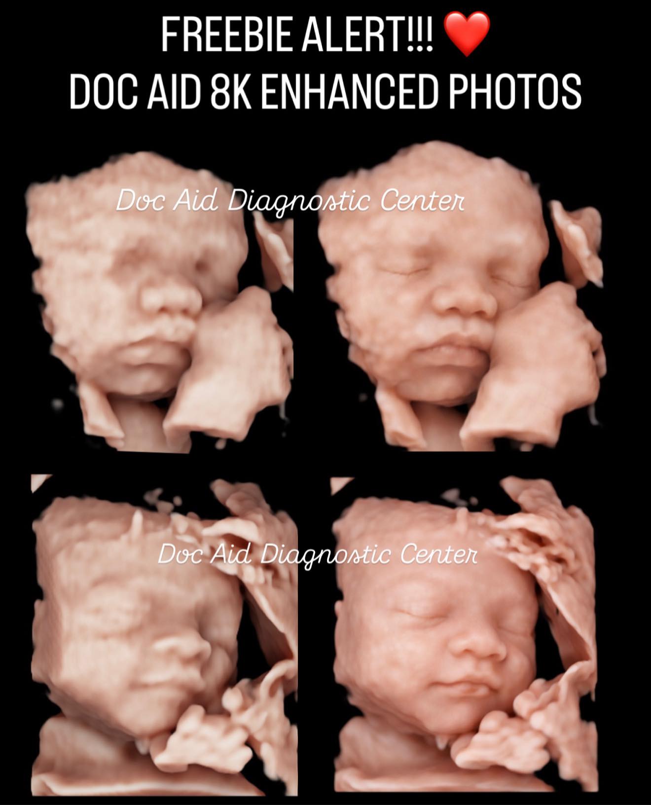 DOC AID Diagnostic Center - QC Branch Facebook ad