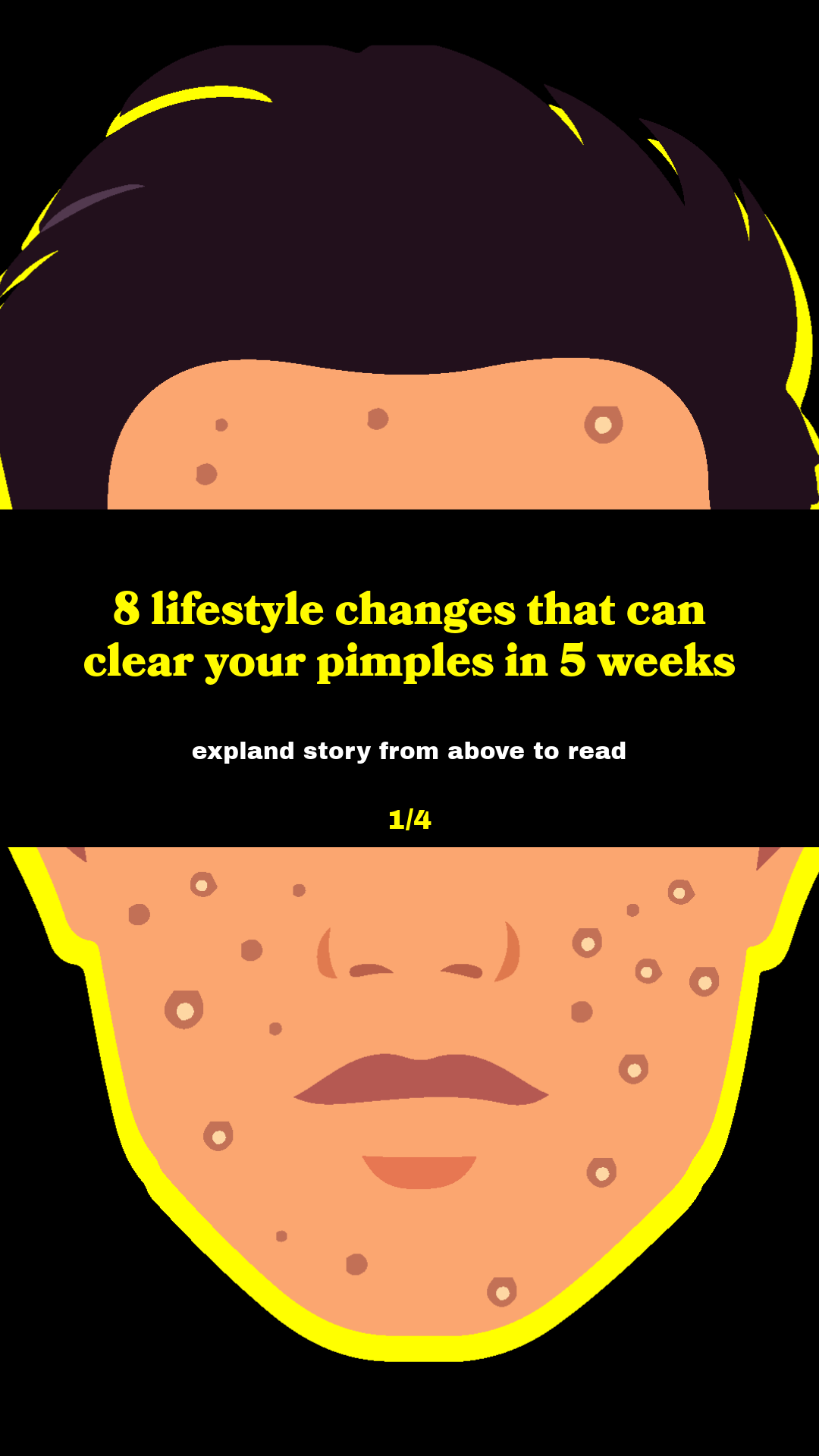 Unhyped acne Facebook ad