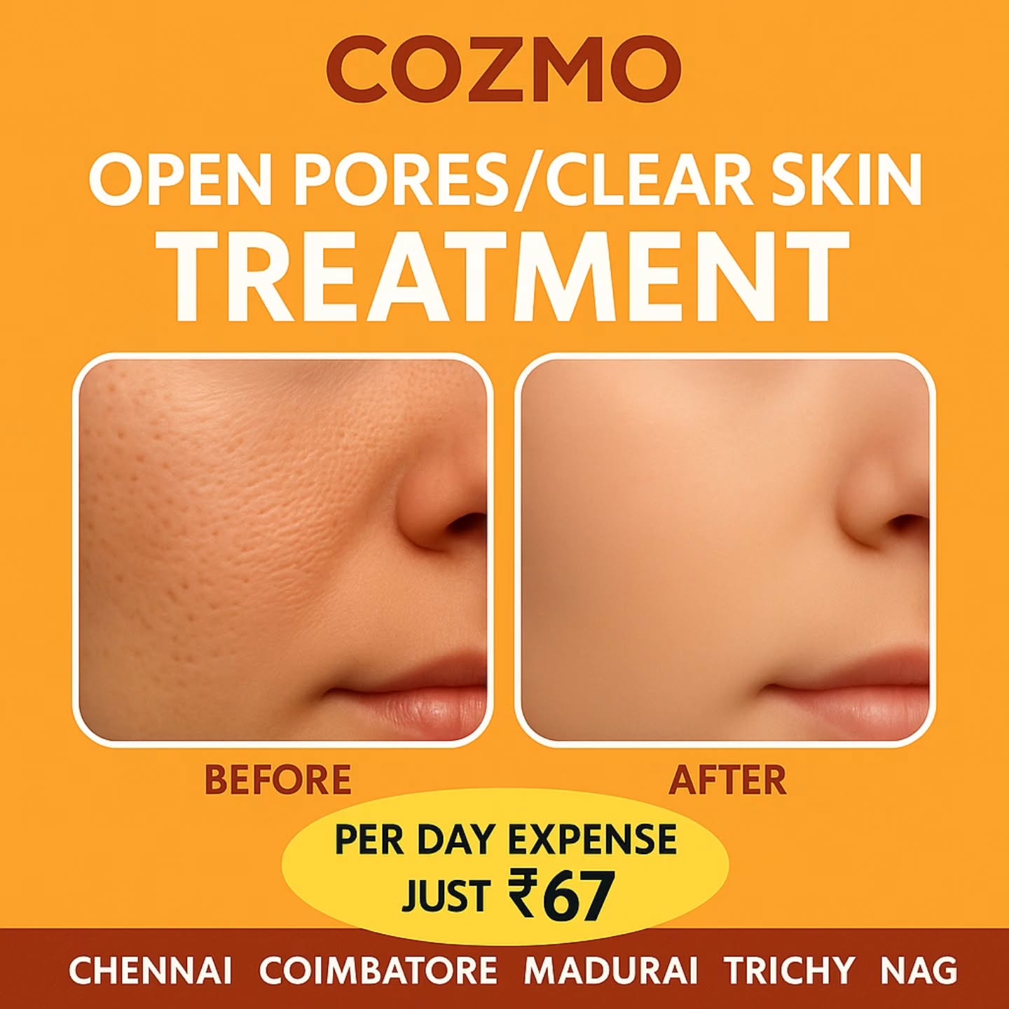 COZMO Skin Care Aesthetic Centre Facebook ad from Dec 19, 2025