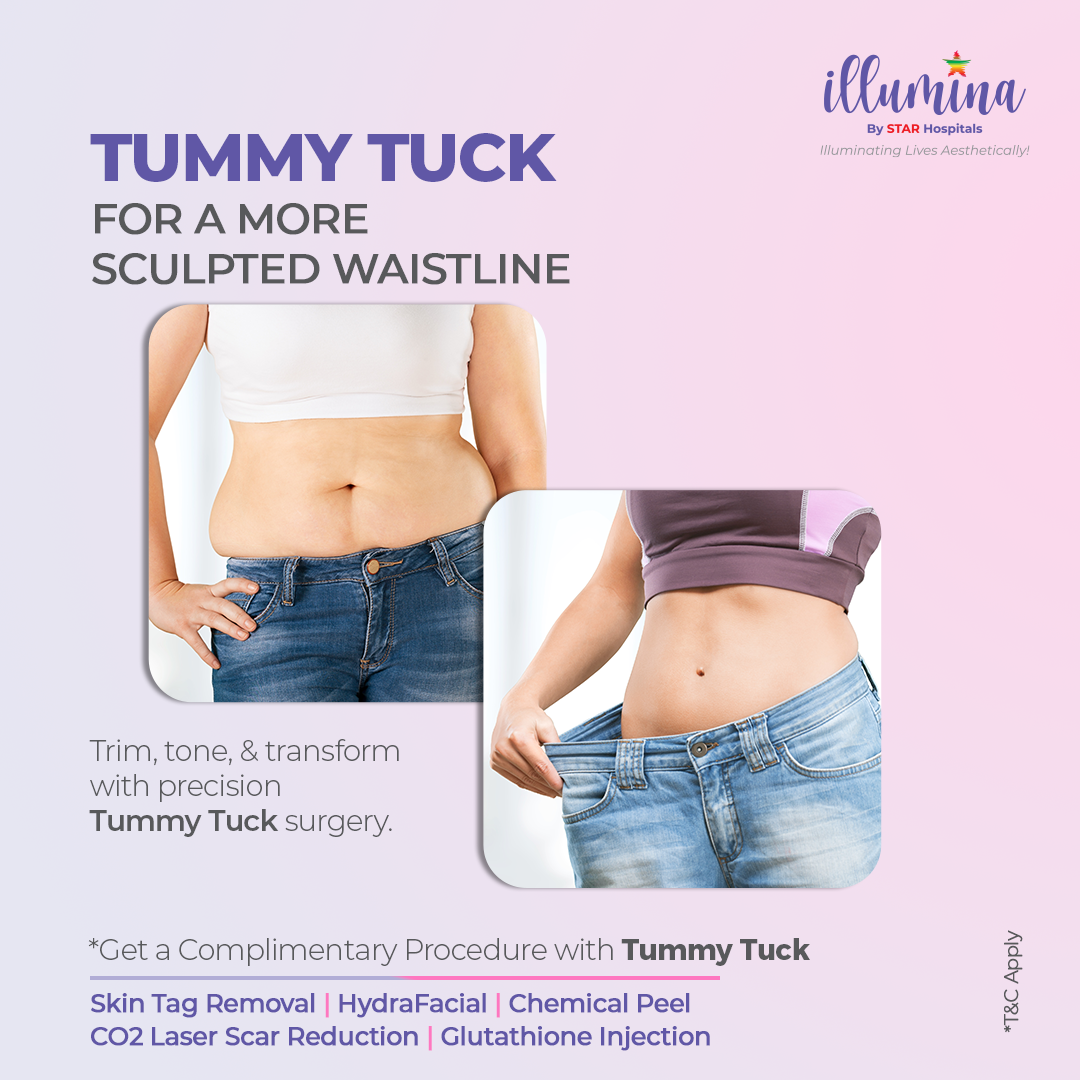 Illumina by Star Hospitals Facebook ad: Looking for safe, advanced cosmetic care?