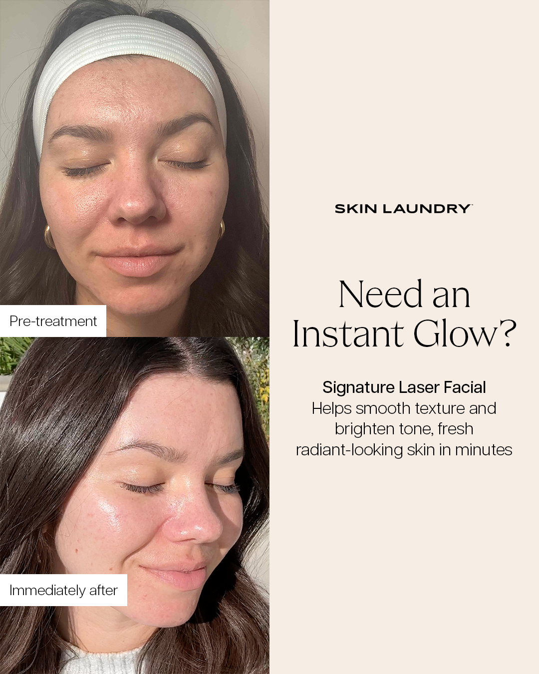 Skin Laundry Facebook ad