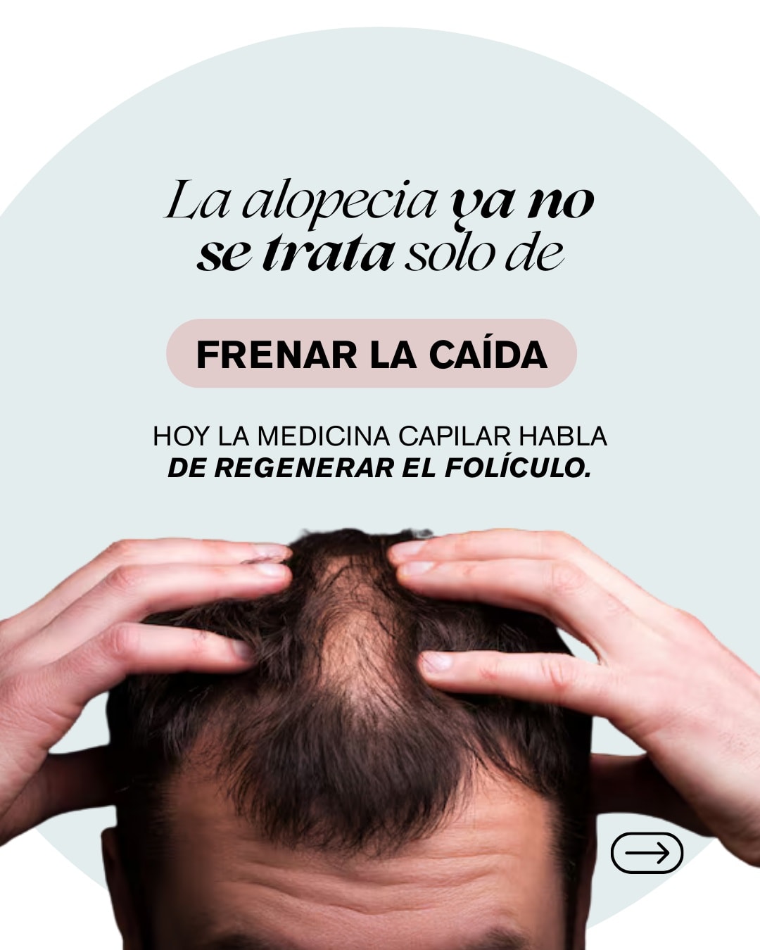 Allure medicina estética Facebook ad: La medicina capilar evolucionó.