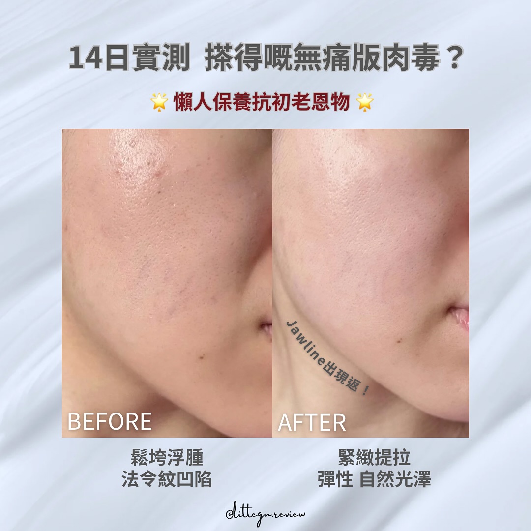 littlegu.makeup Facebook ad: 14日實測 搽得嘅BOTOX @olay.hk OLAY紅金面霜 