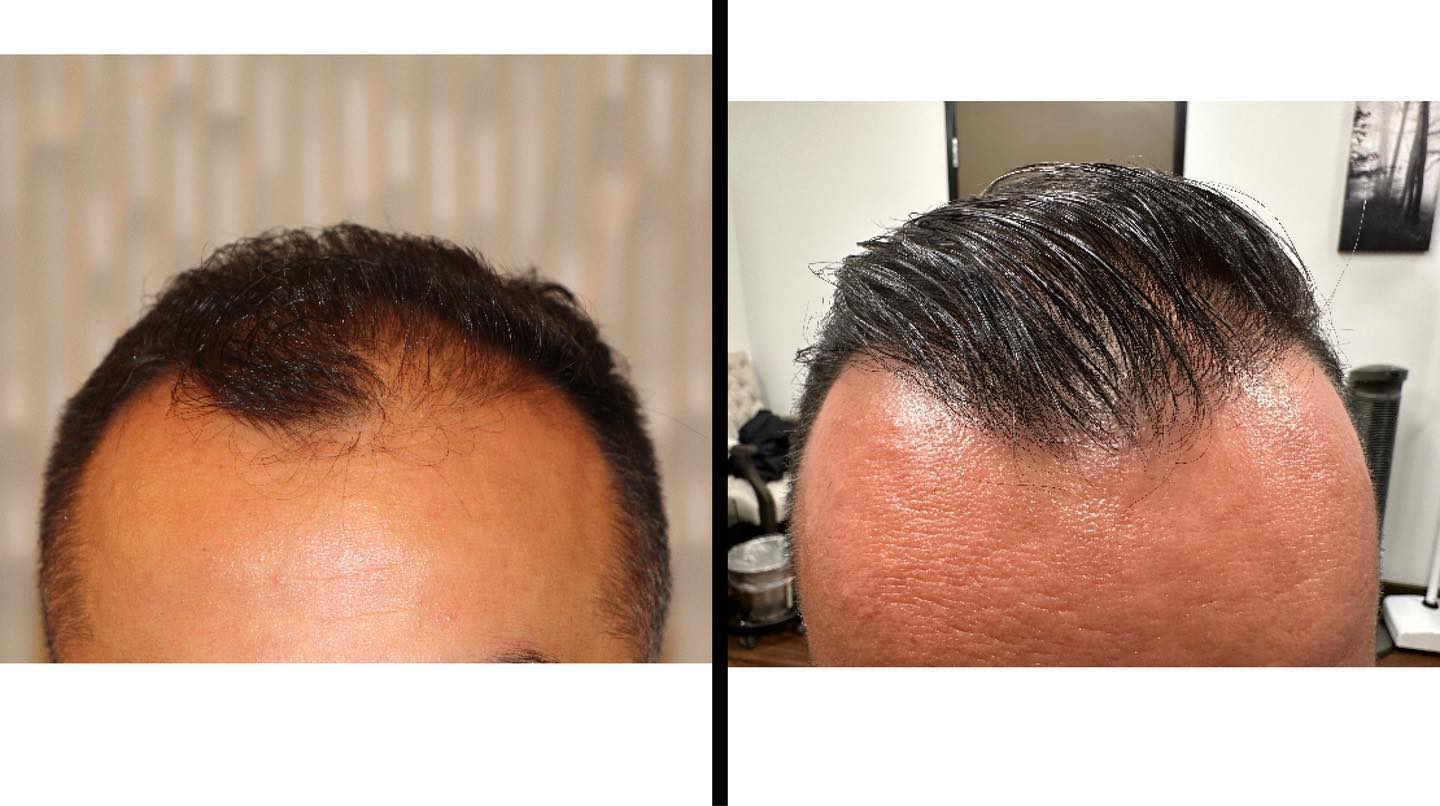 Modena Hair Institute Facebook ad